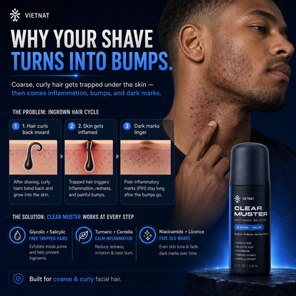VIETNAT Clear Muster Post-Shave Solution for Men — Alcohol-Free Razor Bump & Ingrown Hair Roll-On | For Coarse & Curly Facial Hair, Dark Marks & Shaving Irritation | 4 Fl Oz