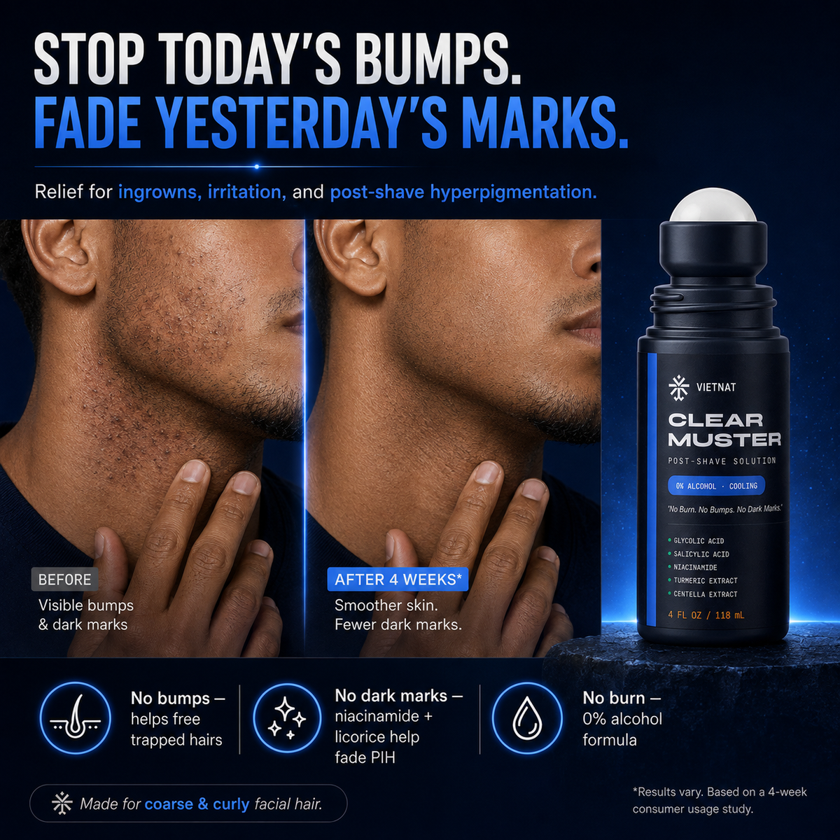 VIETNAT Clear Muster Post-Shave Solution for Men — Alcohol-Free Razor Bump & Ingrown Hair Roll-On | For Coarse & Curly Facial Hair, Dark Marks & Shaving Irritation | 4 Fl Oz