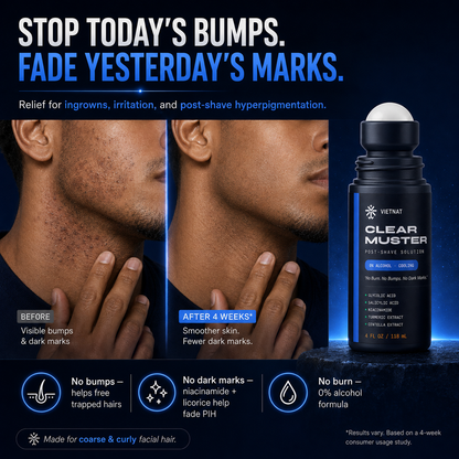 VIETNAT Clear Muster Post-Shave Solution for Men — Alcohol-Free Razor Bump & Ingrown Hair Roll-On | For Coarse & Curly Facial Hair, Dark Marks & Shaving Irritation | 4 Fl Oz
