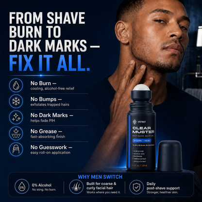 VIETNAT Clear Muster Post-Shave Solution for Men — Alcohol-Free Razor Bump & Ingrown Hair Roll-On | For Coarse & Curly Facial Hair, Dark Marks & Shaving Irritation | 4 Fl Oz
