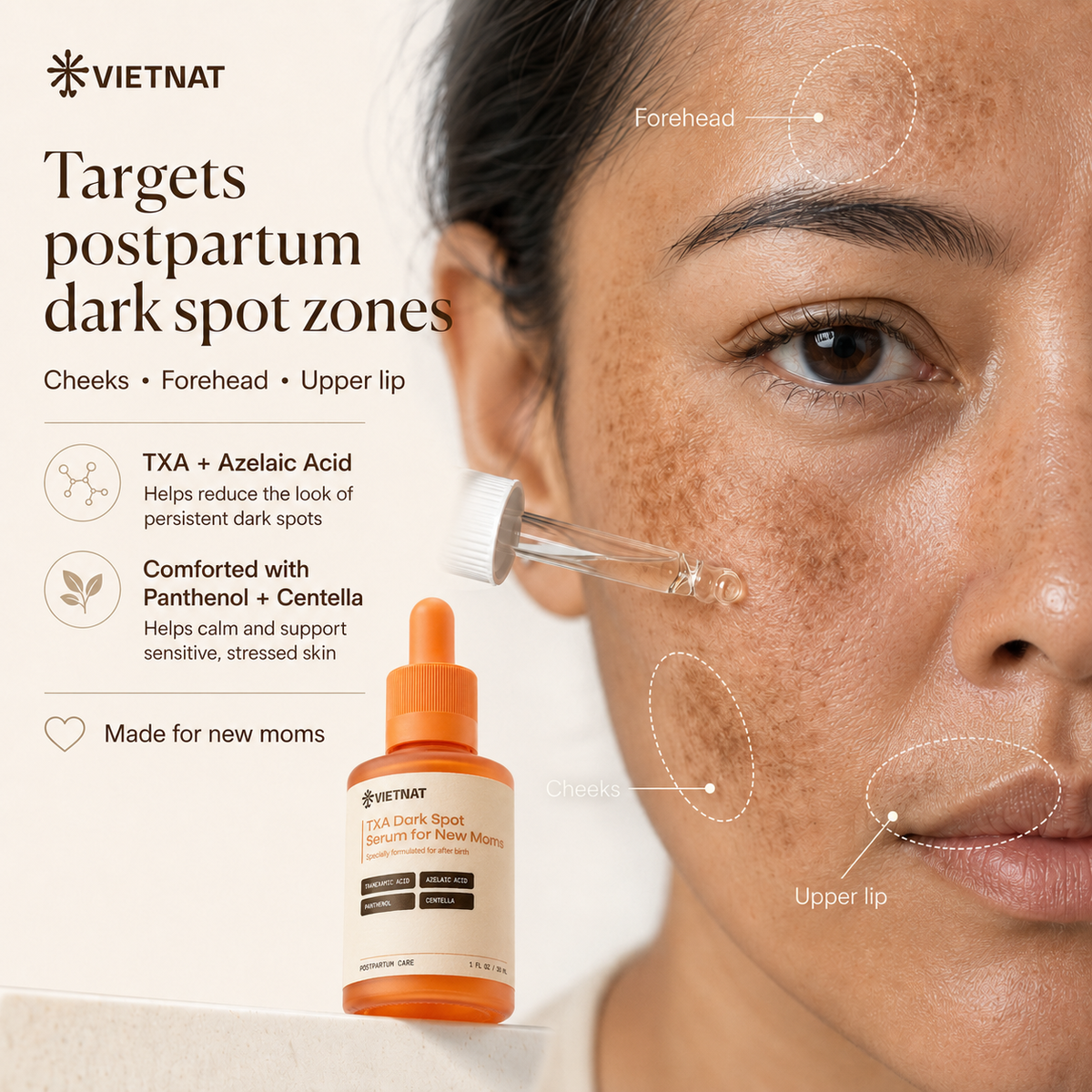 VIETNAT TXA Dark Spot Serum for New Moms with Tranexamic Acid & Azelaic Acid, Formulated for After Birth (Copy)