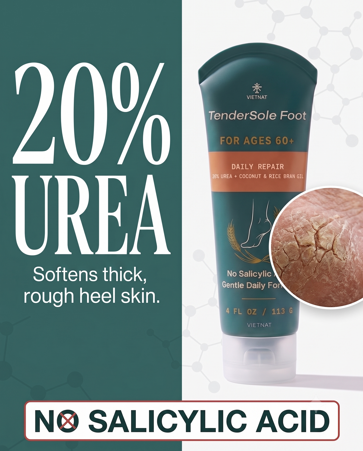 VIETNAT TenderSole Daily Repair Cream for Ages 60+| For dry, rough, thickened heels with Urea + Vietnamese Coconut Oil & Rice Bran Oil| 4 FL OZ / 113 G